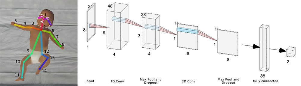 Abnormal Infant Movements Classification with Deep Learning on Pose-based Features