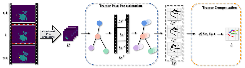 Stable Hand Pose Estimation under Tremor via Graph Neural Network